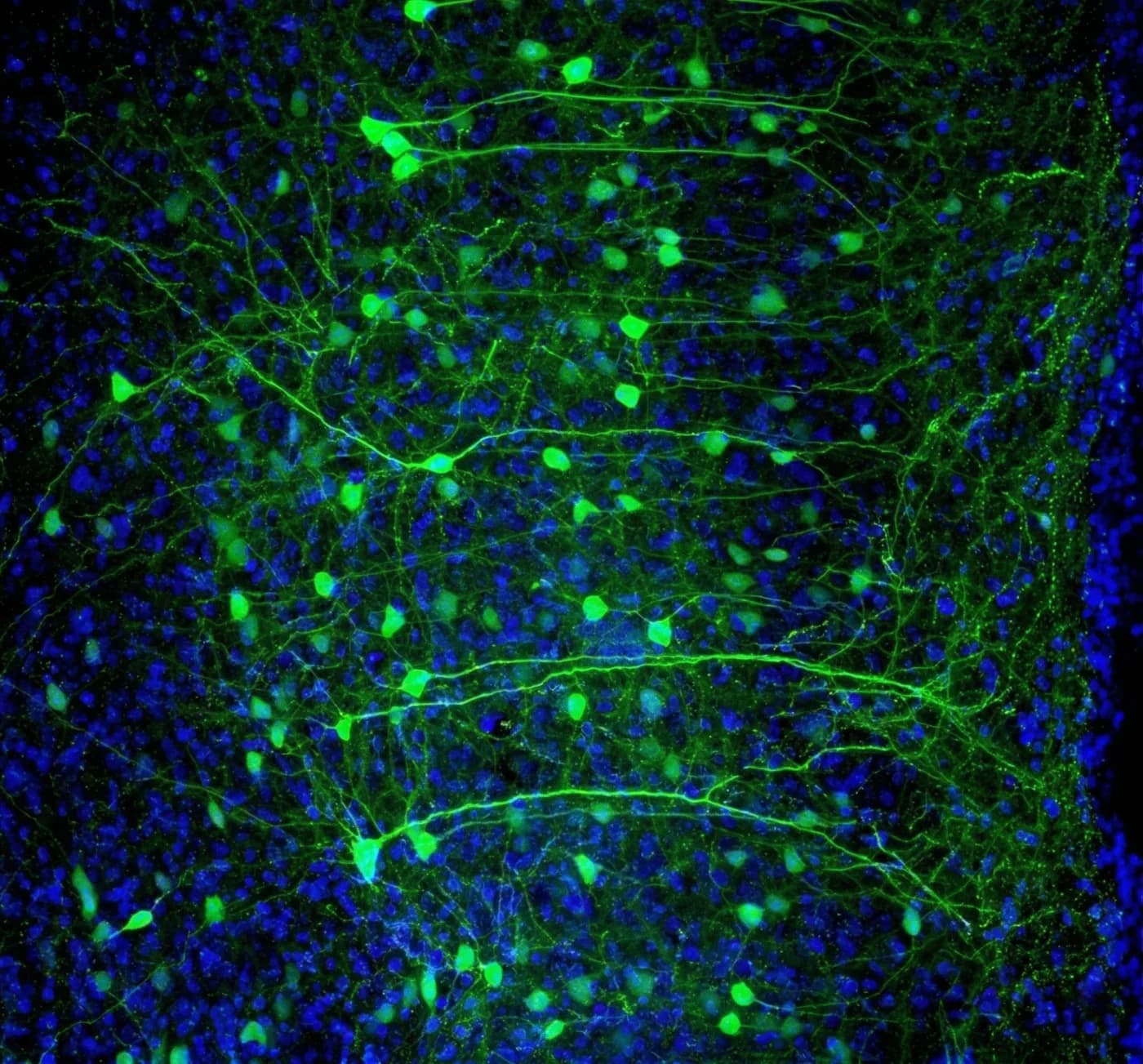 AAV8-hChR2-EYFP labeled neurons with green cell bodies and dendrites against DAPI blue counterstain