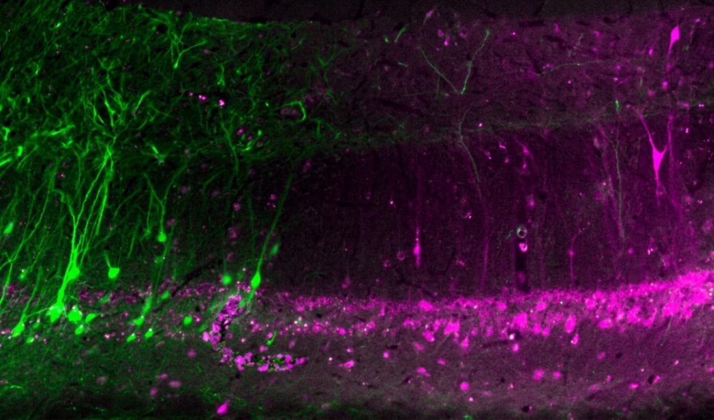 Dual AAV co-injection showing green EFS-Cas13d neurons and magenta E2-Crimson-U6-DR30-gRNA expression